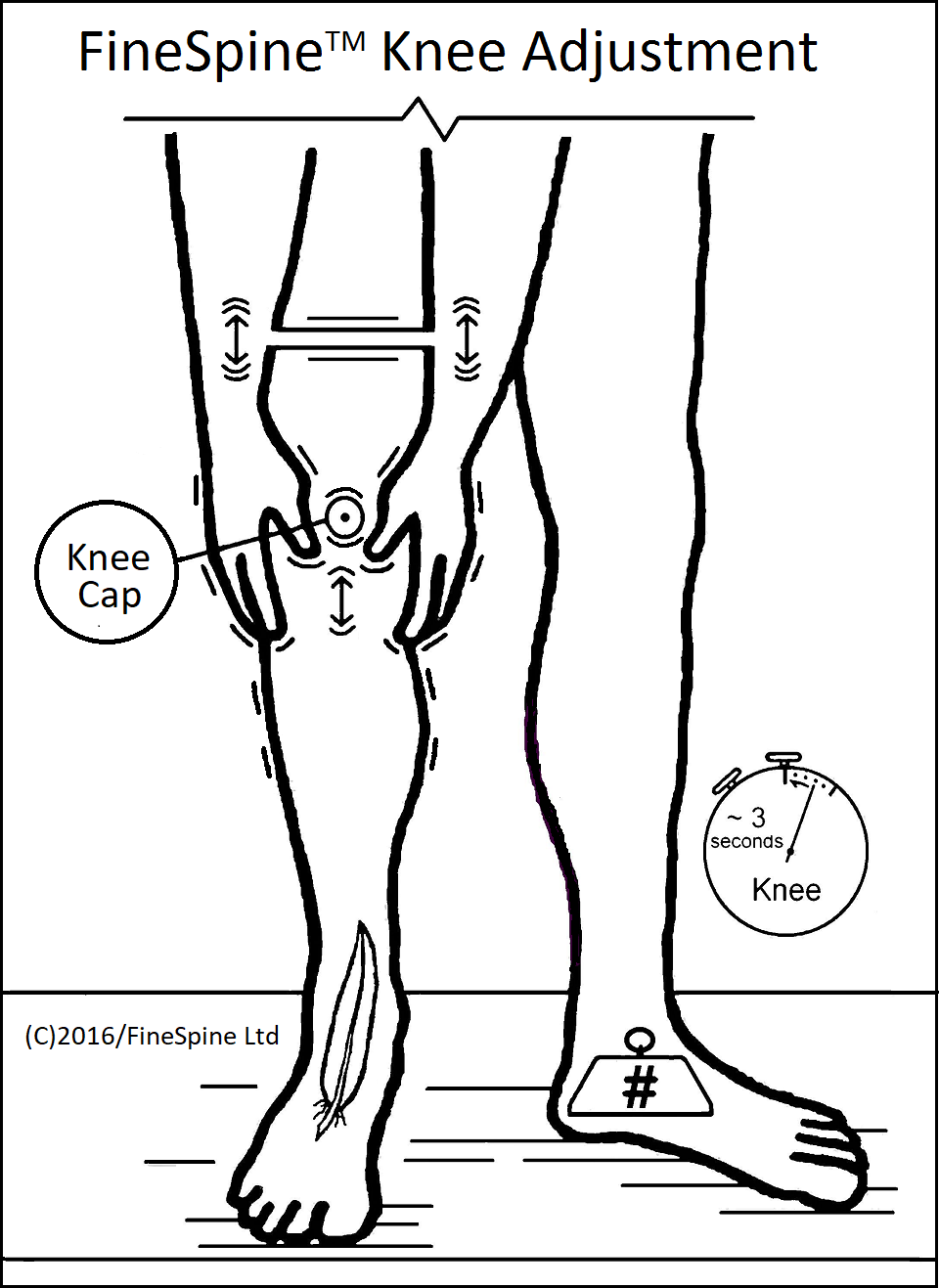 Knee Method Knee Pain Relief – The FineSpine™ Method